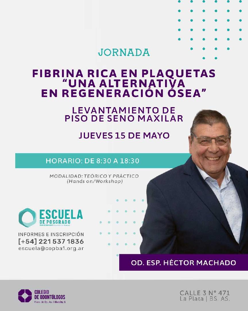 FIBRINA RICA EN PLAQUETAS ( A-PRF  I-PRF ) UNA ALTERNATIVA EN REGENARACION OSEA.  LEVANTAMIENTO DE PISO DE SENO MAXILAR